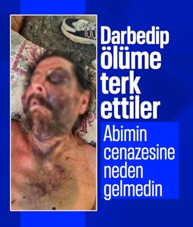 İzmir'de darbedilen adam, metruk evde ölüme terk edildi