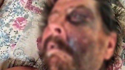 İzmir'de darbedilip ölüme terk edildi: Beyin kanaması geçiren adam yoğun bakımda