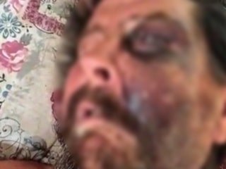 İzmir'de darbedilip ölüme terk edildi: Beyin kanaması geçiren adam yoğun bakımda