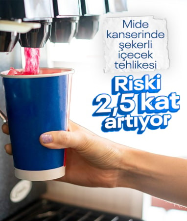 Şekerli içecekler ilk kez mide kanseriyle ilişkilendirildi