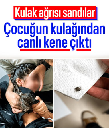 Eskişehir'de çocuğun kulağından canlı kene çıkartıldı
