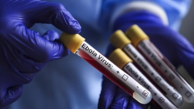 Kongo'da Ebola salgını: 2 bin 786'dan fazla can kaybı