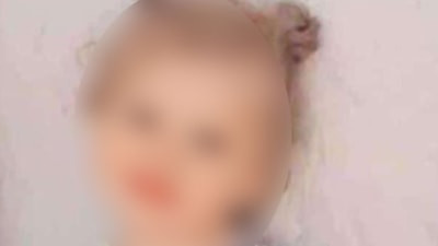 Diyarbakır'da kuduz teşhisi konulan 4 yaşındaki çocuk kurtarılamadı