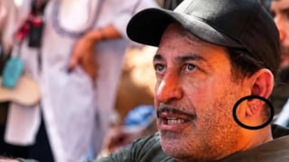Cem Yılmaz'da dikkat çekti! Kulak memesindeki 'Frank' işareti ve anlamı...