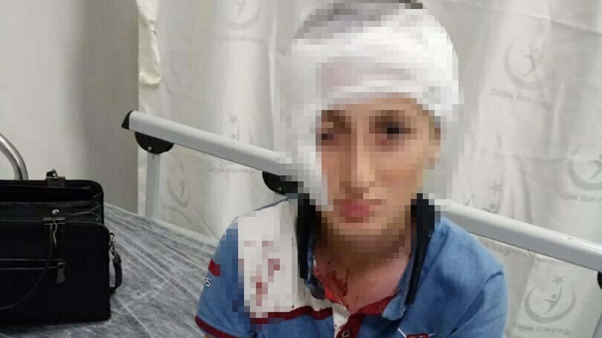 İzmir'de köpek saldırısında yaralanan çocuğa tazminat ödenecek