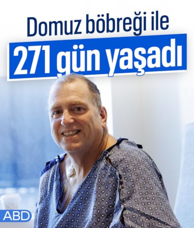 ABD'de genetiği değiştirilmiş domuz böbreğiyle 271 gün diyalize girmeden yaşadı