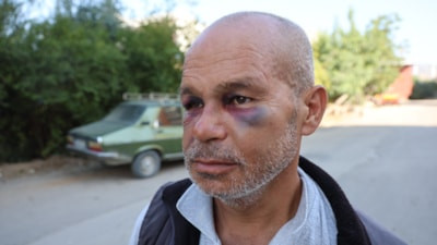 Adana'da duyma ve konuşma engelli adam darbedildi