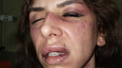 İstanbul'da eşi tarafından saatlerce darbedilen kadından yardım çığlığı