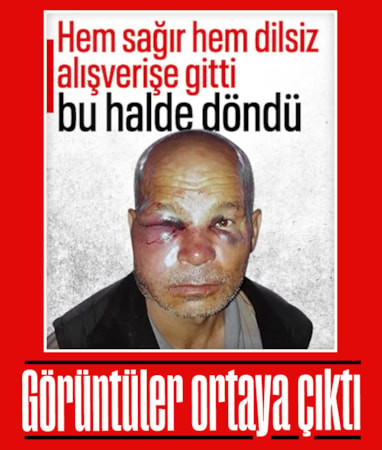 Adana'da duyma ve konuşma engelli adamın darbedildiği anların görüntüsü ortaya çıktı