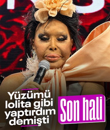 Lolita estetiğinden sonra