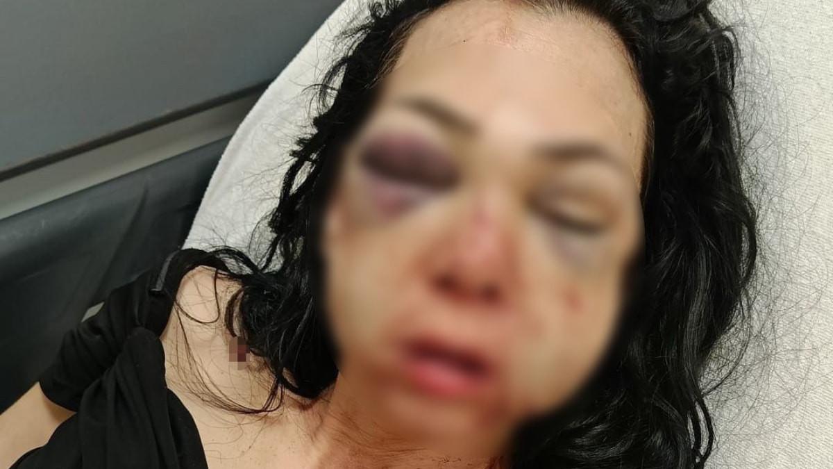 Kocaeli'de kadının yüzünü bardak ve kül tablasıyla kıran şüpheli tutuklandı