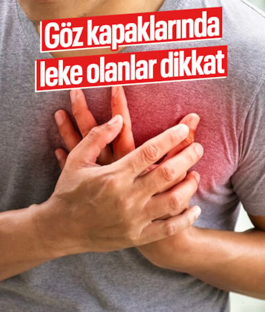 Göz kapaklarındaki sarı lekeler kalp ve inme riskinin habercisi olabilir