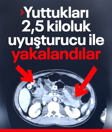 Erzincan'da şüphelilerin mide ve bağırsaklarından 2 kilo 675 gram afyon sakızı çıktı