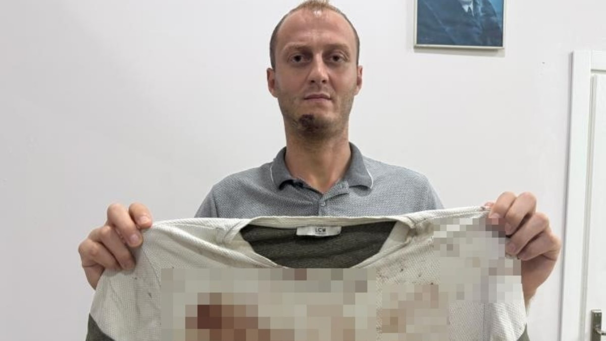 Antalya'da gürültü tartışması sopalı kavgayla bitti
