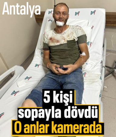 Antalya'da gürültü tartışması sopalı kavgayla bitti