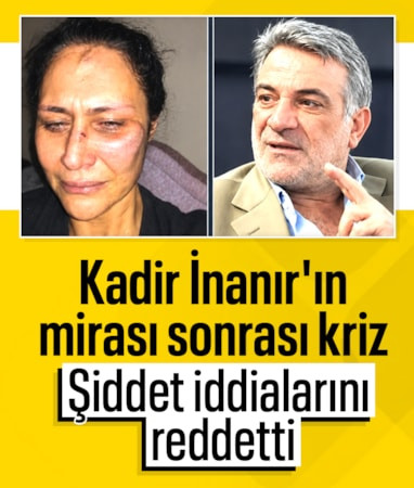 Kadir İnanır'ın yeğeni Levent İnanır'dan açıklama! Eski eşinin şiddet iddialarına yanıt verdi