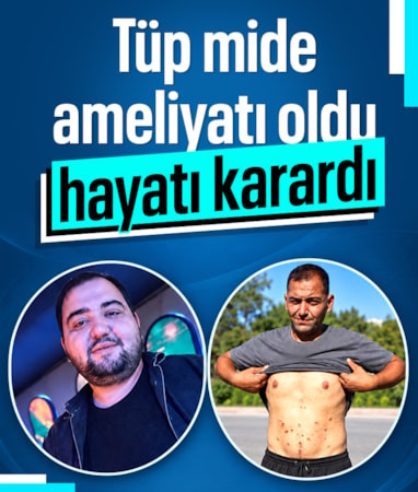 Adana'da tüp mide ameliyatı oldu, hayatı karardı