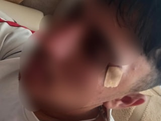 Afyonkarahisar'da öğretmenin kafa attığı çocuğun burnu kırıldı