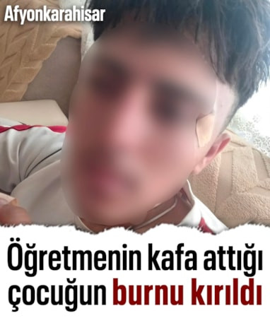 Afyonkarahisar'da öğretmenin kafa attığı çocuğun burnu kırıldı