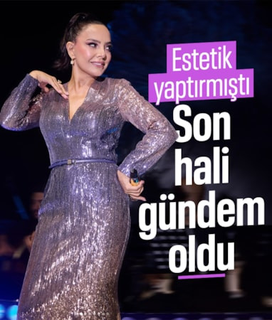 Estetik için servet ödemişti! Ebru Gündeş'in son fotoğrafları gündem oldu