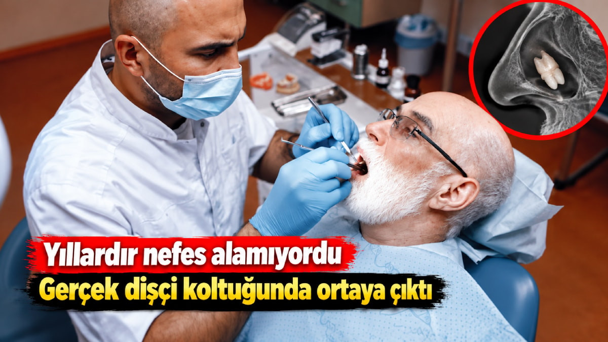 Dişçiye gitti, hayatının şokunu yaşadı: “Yıllardır nefes alamıyordum"