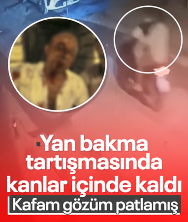İstanbul'da 'yan bakma' kavgasında darbedilip kanlar içinde kaldı: Her şeyim patladı