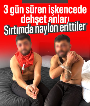 İstanbul'da dehşet evinde 3 gün süren işkence: Sırtımda naylon erittiler