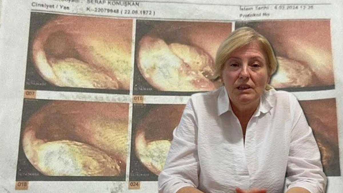 Manisa'da ameliyatta gazlı bez unutulduğu iddiasıyla 2 doktor hakkında dava