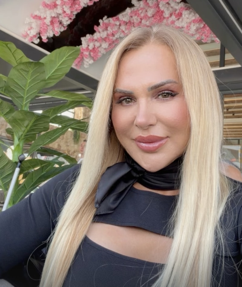 Survivor Nagihan Karadere: Estetik Yatırımları ve Son Güncellemeler