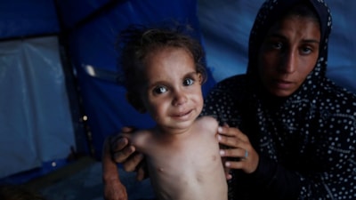 Gazze'de bebekler beslenme sıkıntısı yaşıyor