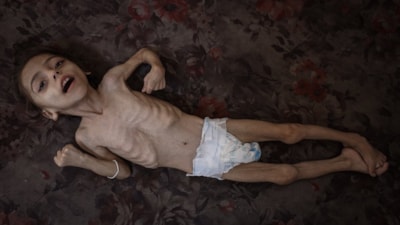 Gazze'de çocukların açlıkla imtihanı