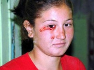 Gerçekten kan ağlıyor