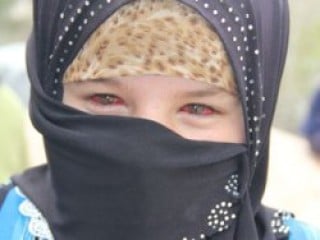 Suriye'deki savaşın hiç görülmemiş kanlı fotoğrafları