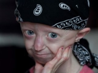 104 yaşındaki genç kız 17 yaşında hayatını kaybetti