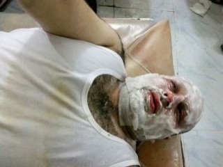 Halep'teki AA muhabiri füze saldırısında yaralandı