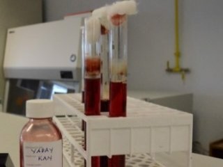 ’Yapay kan’ denemeleri başlıyor