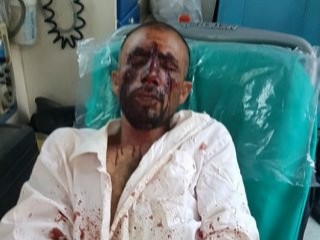 Yunan faşistlerden göçmenlere saldırı