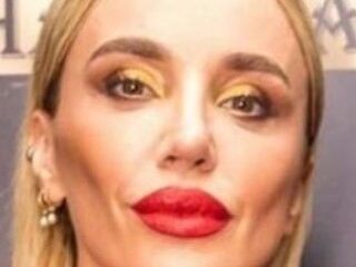 Gülşen'in yüzündeki değişiklik