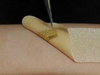 Giyilebilir sensörler yaraların iyileşmesine yardım ediyor