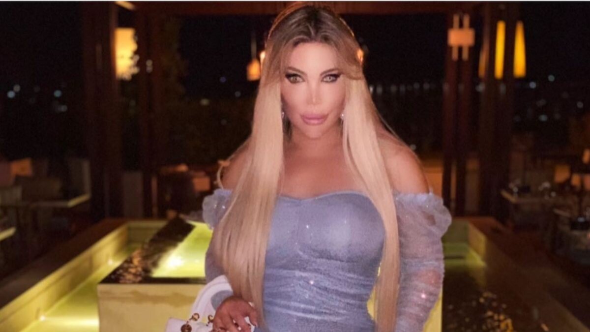 Brezilyalı adam, Barbie’ye benzemek için 70 estetik ameliyat geçirdi