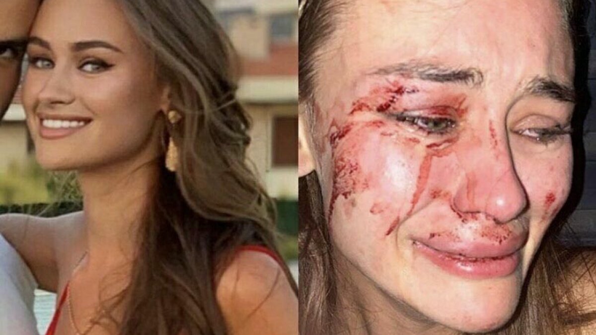 İzmir’de darbedilen Ukraynalı model, özrü kabul etti