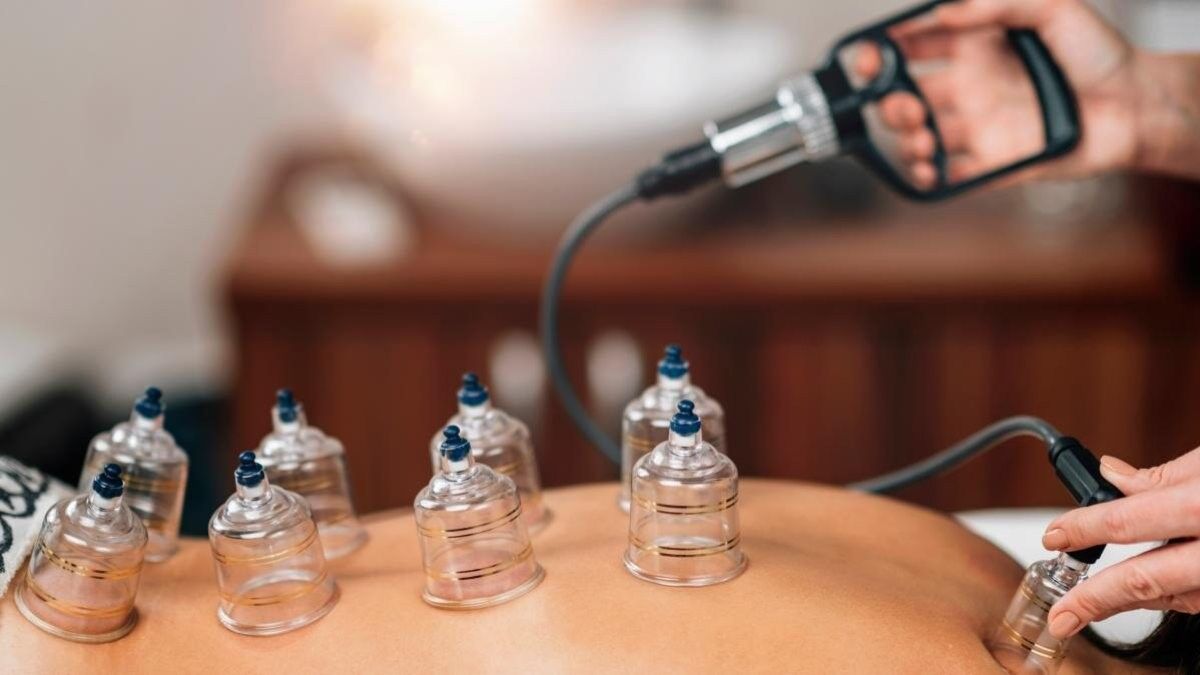 Hacamat günleri 2022: Mart ayında hangi günler hacamat yapılır