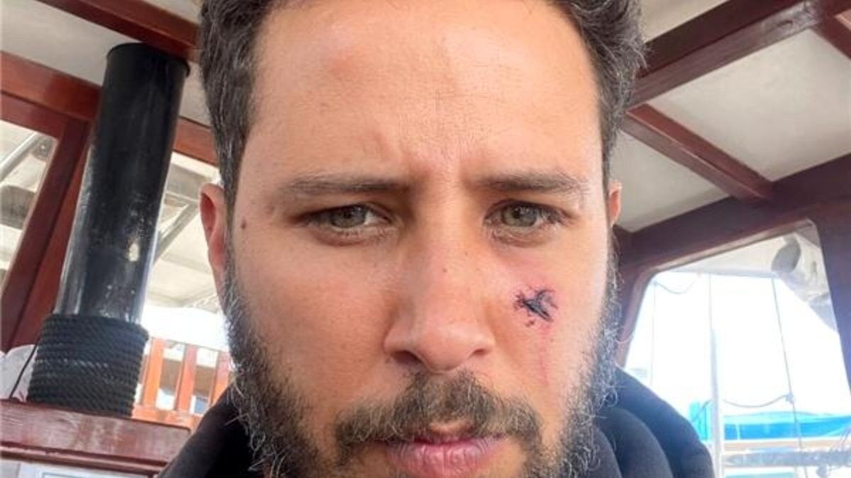 Tuan Tunalı'ya köpek saldırdı