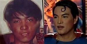 Superman'e benzemek için 16 defa estetik oldu
