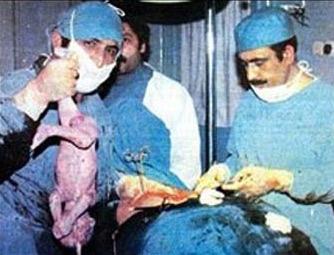 Maraş katliamının simge doktoru 33 yıl sonra konuştu