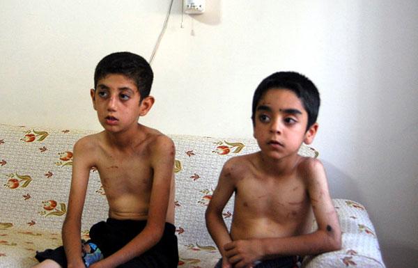 Şeker toplayan çocuklara işkence yaptılar