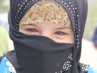 Suriye'deki savaşın hiç görülmemiş kanlı fotoğrafları