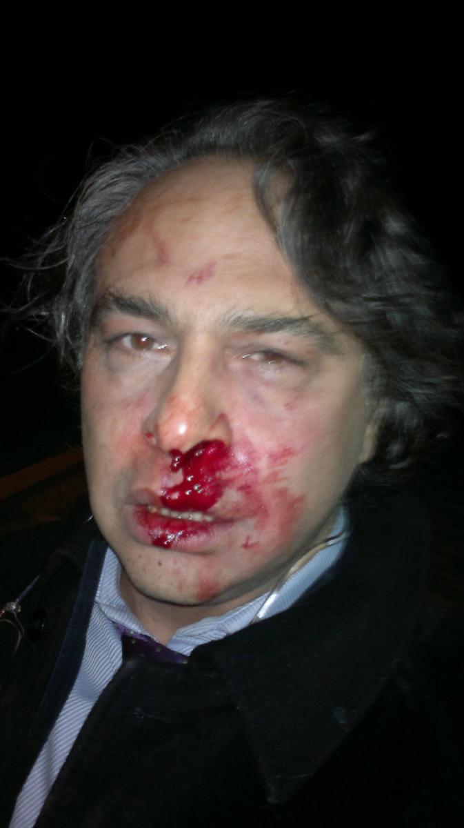 Barbaros Şansal Taksim'de saldırıya uğradı