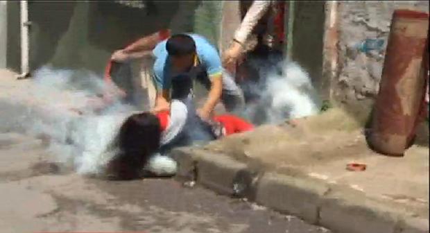 Kafasına gaz bombası gelen Dilan Alp ameliyata alındı