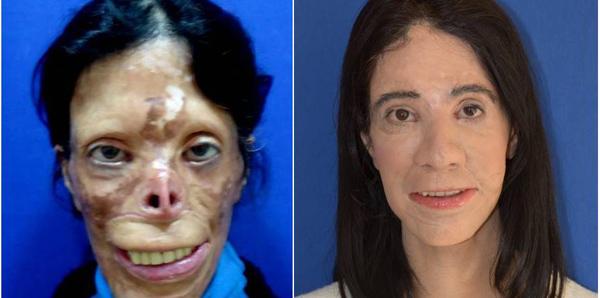 Dünyanın konuştuğu Türk doktor Mehmet Mutaf eskiden şarkıcıydı